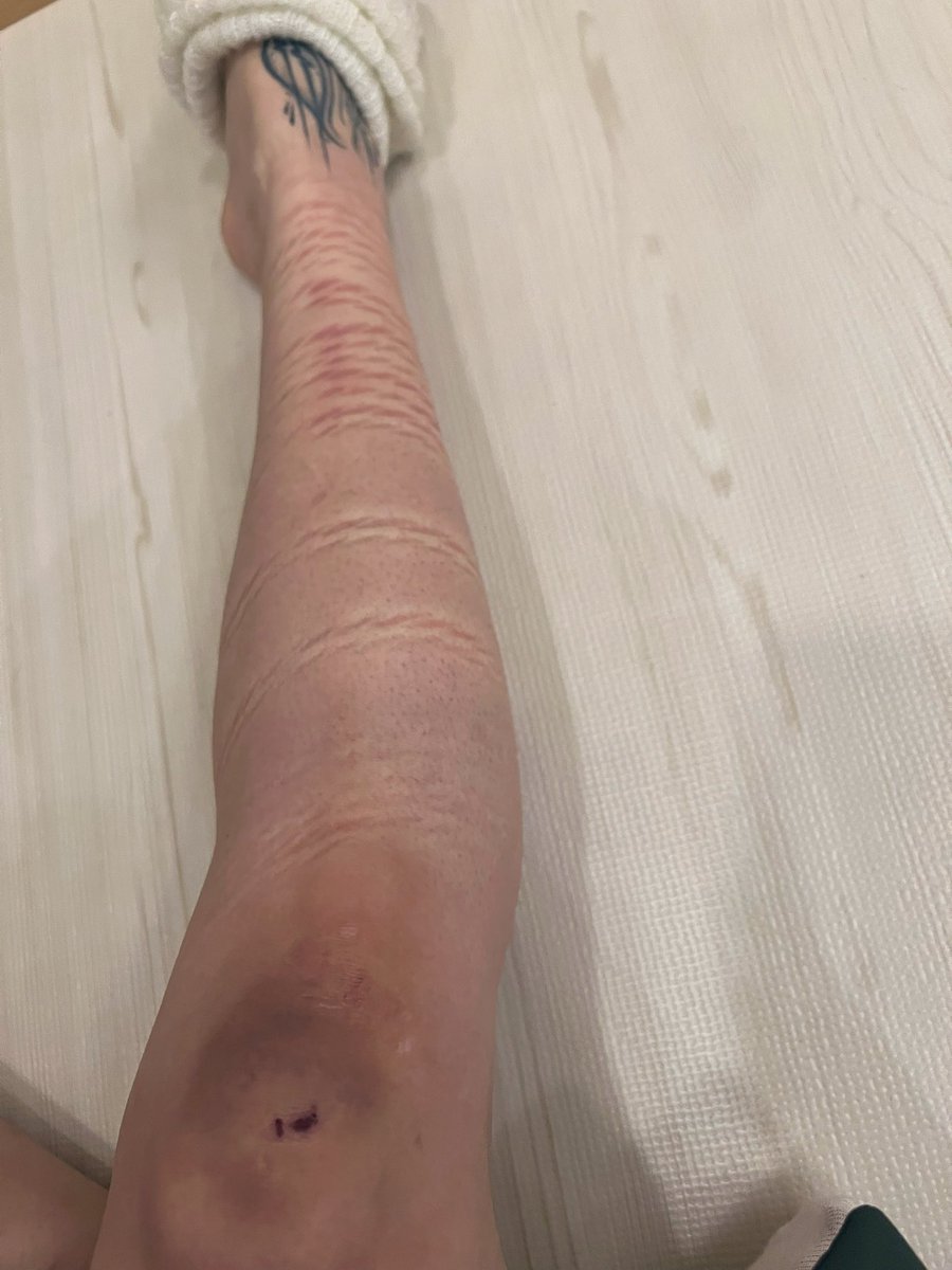 요오... 오랜만에 줄자국