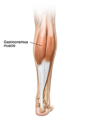 basemstat's tweet photo. خلف الساق توجد عضلتين
🔴 العضلة الأولى تسمى عضلة الساق Gastrocnemius و هي تنتمي لمجموعة عضلات نسميها العضلات سريعة الإنقباض Fast-twitch muscle و هي تستخدم في الحركات السريعة مثل القفز و الجري
هذا النوع من العضلات سريعة الإنقباض و تستهلك طاقة عالية من مخزون العضلة من الجلايكوجين (نوع من الكاربوهيدرات) و دون الحاجة للأوكسجين و هو التمثيل اللاهوائي Anaerobic metabolism 
و بعد إستهلاك هذا المخزون تبدأ العضلة في الإعتماد على سكر الدم كمصدر للطاقة