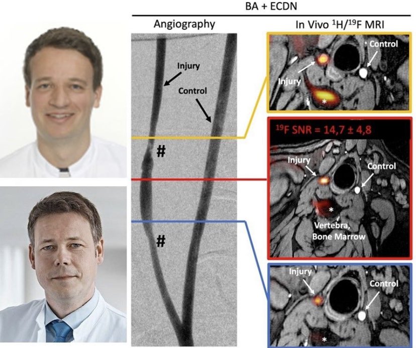 Want to see the future of cardiovascular #inflammation imaging ? Join the JCMR journal club next Wednesday at 11AM EST (lnkd.in/eBZZdfmx) when we discuss fluorine-19 MRI in a porcine model of vascular inflammation (lnkd.in/eZXqijAv). See you there!