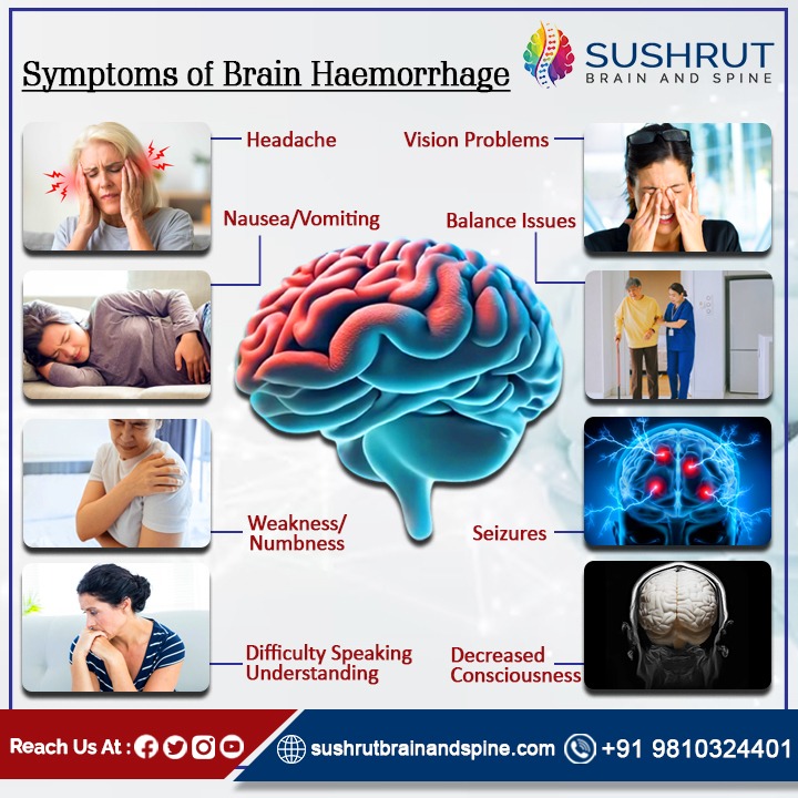 If you or someone experiences these symptoms, seek immediate medical attention. Awareness is key. Stay informed, stay safe.

#BrainHealth #KnowTheSigns #HealthAwareness #BrainHemorrhage
#NeurologicalHealth #StrokeAwareness #BrainHealth #HemorrhagicStroke #CerebralHemorrhage
