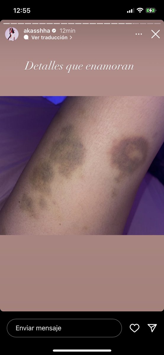 adyyaltce's tweet photo. lo que subió la novia de Alemán, Akasha 😣 alv https://t.co/TZsrbEMbcD