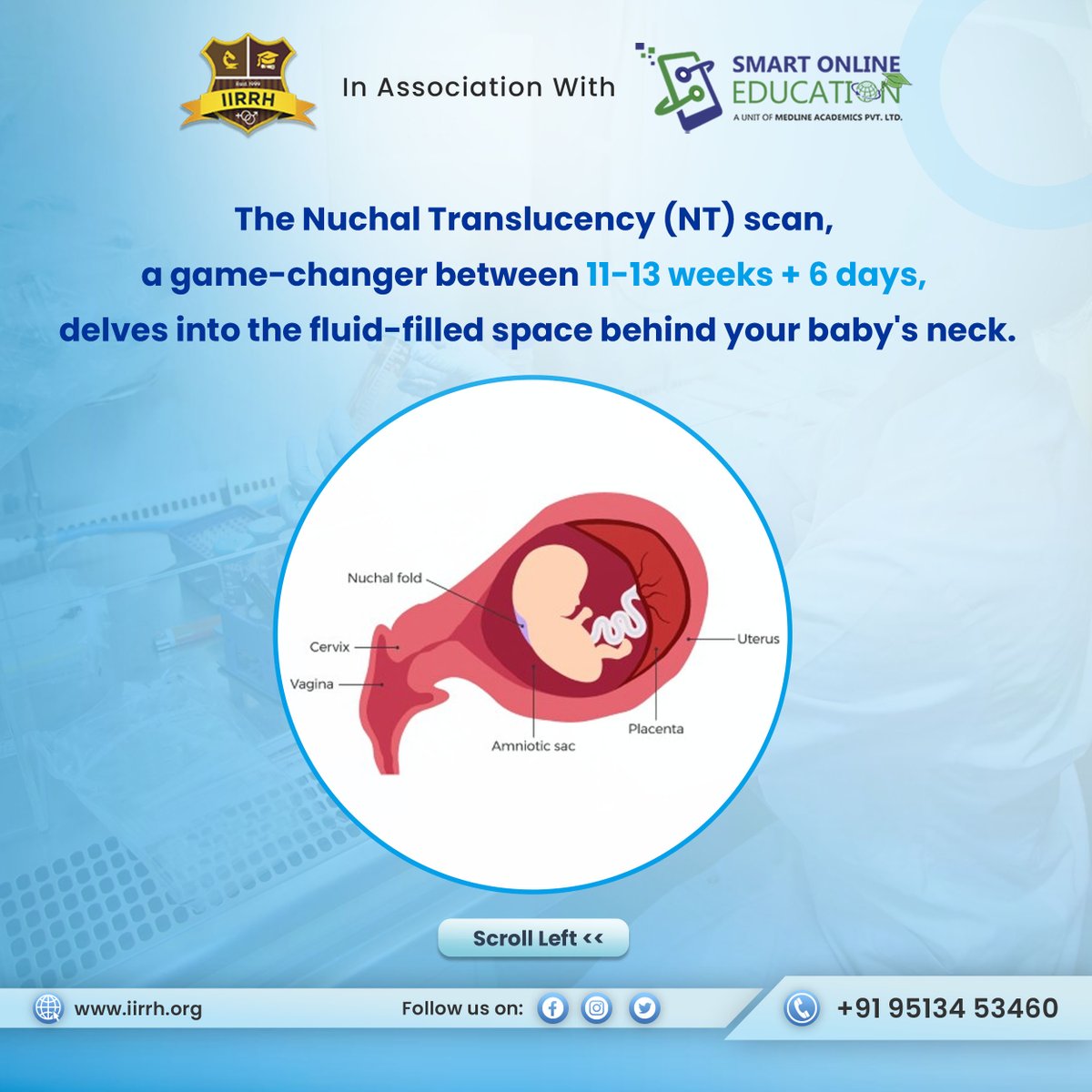 iirrh_institute's tweet image. Join our First Trimester Ultrasound Course for a comprehensive understanding!

To know more, visit iirrh.org/training-certi… or call on +91 9513453460

#Pregnancy #NTScan #FirstTrimester #USGCourse #FirstTrimesterUltrasound #BasicsOfUltrasound #LearnWithMedline
