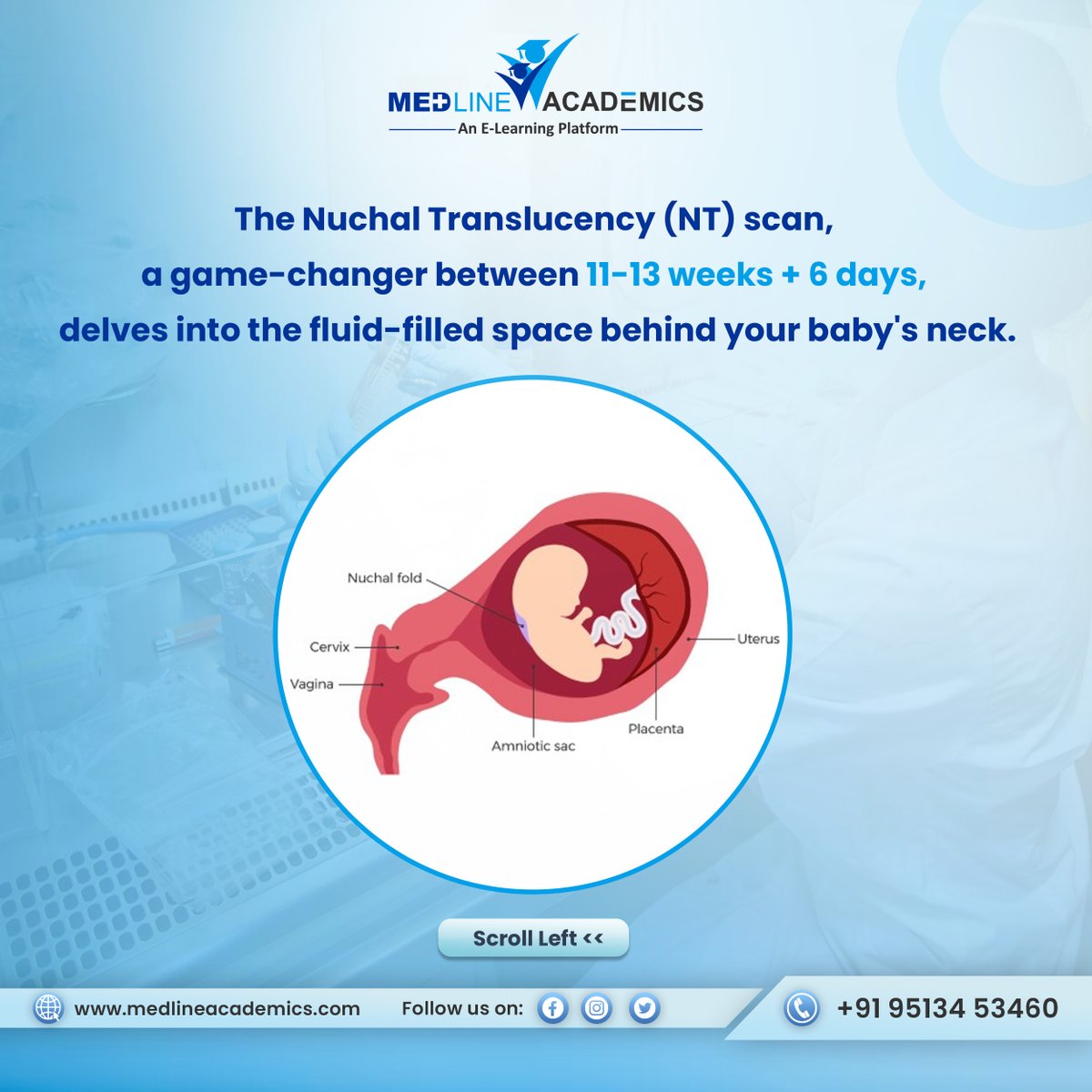 MedlineAcademic's tweet image. Join our First Trimester Ultrasound Course for a comprehensive understanding!

To know more, visit medlineacademics.com or call on +91 9513453460

#Pregnancy #NTScan #FirstTrimester #USGCourse #FirstTrimesterUltrasound #BasicsOfUltrasound #LearnWithMedline