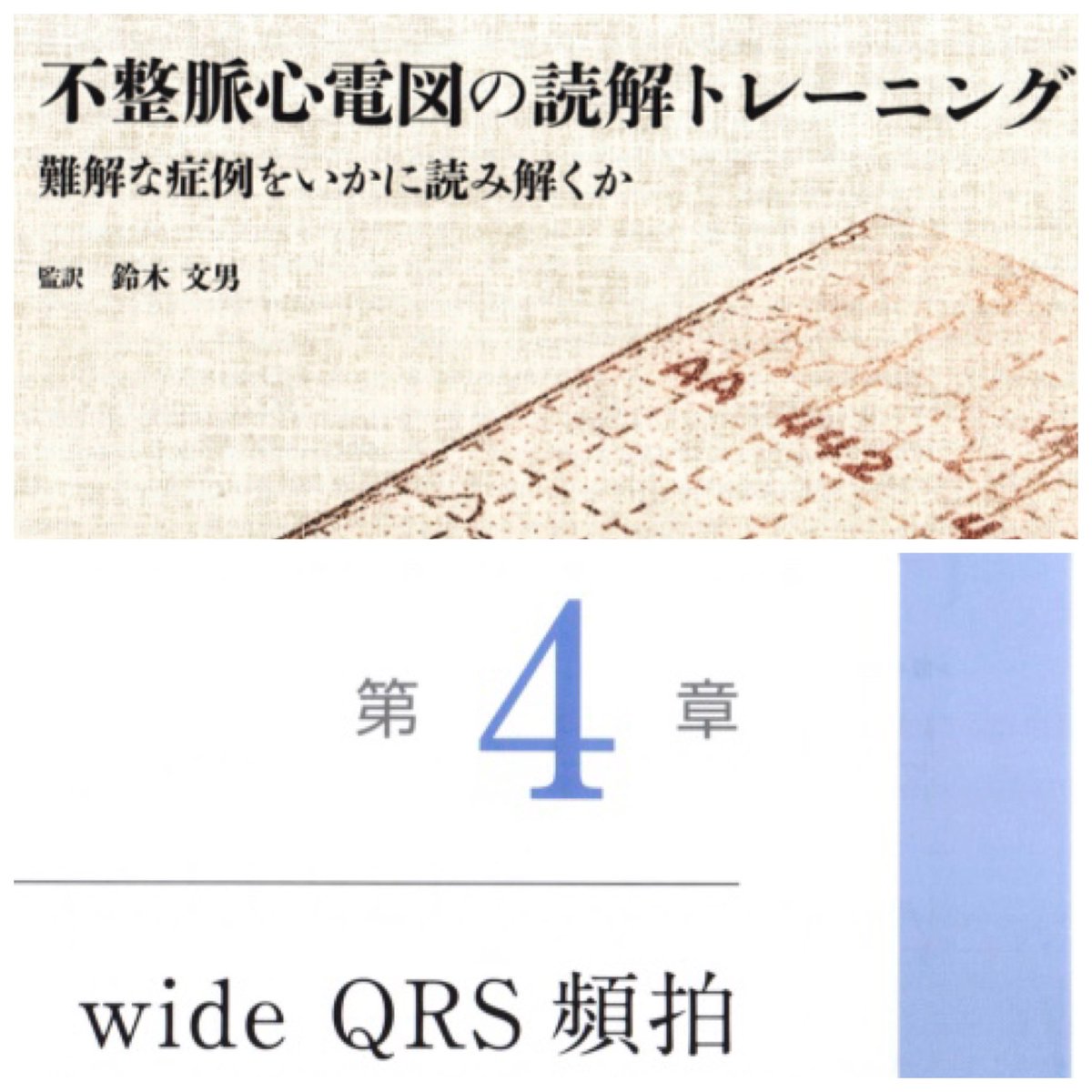 pakitapedicare's tweet photo. #不整脈心電図の読解トレーニング 難解な症例をいかに読み解くか
鈴木文男
第4章　12/17点

解説が難しく理解するのに時間を要する(出来ない所もある)！思いっきりvtとおもてもstなどある。心房波を正しく同定せよ！など多くのメッセージあり直前にする問題集ではないかもしれないが、深い学びはある！ https://t.co/WEX3Mv599e