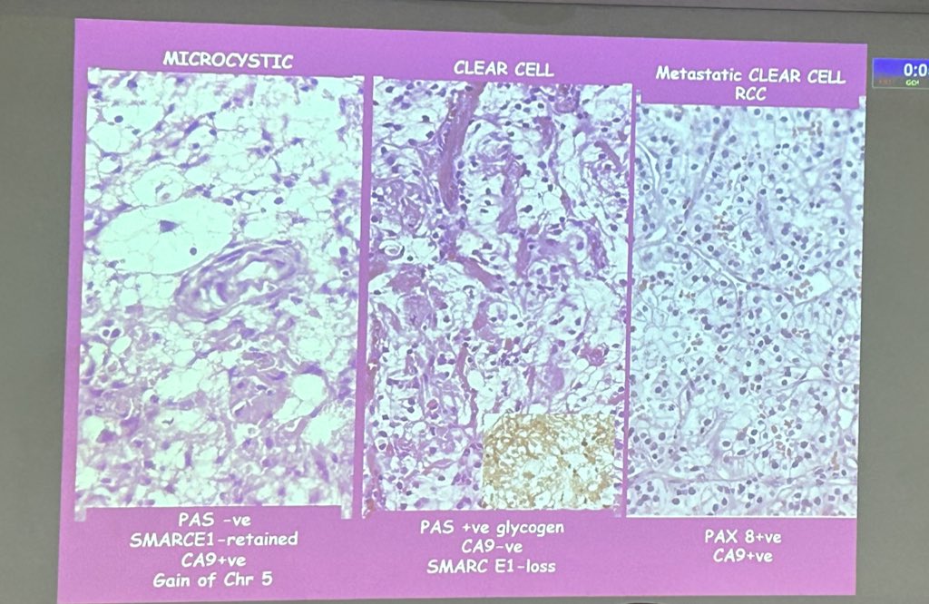 pathridle_susan's tweet image. Neuropathology  #Apcon2023
#pathtwitter #pathology #pathboards #neuropath #PathX