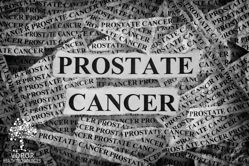 Discovery in action - Targeted Prostate Cancer Healthcheck - supporting NHS's post-pandemic cancer recovery objectives + Long Term Plan cancer ambition to diagnose 75% of all cancers at an earlier stage, by 2028. voror.co.uk/Prostate_Cance… linkedin.com/feed/update/ur… @ShaneTickell