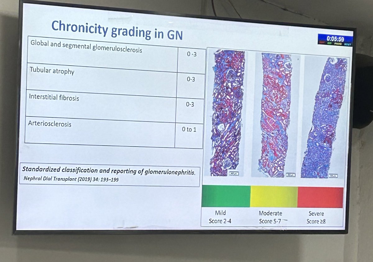 pathridle_susan's tweet photo. Approach to Renal Biopsy Reporting #Apcon2023 #Askrenal #pathology #pathtwitter #PathX #nephropath #renalpath #Renalpath #pathboards #Pathtwiiter #Nephpearls #Kidneypath https://t.co/izDTIuDz9R