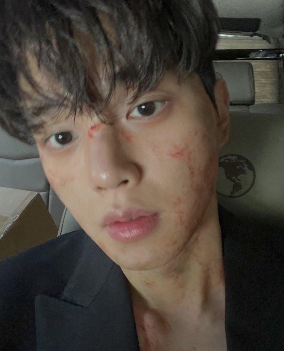 I-igw mwoya? phi? Blood sweet &amp; tears in my face wdy hey chingu why so kamcagi? Heol uri chingu anichana