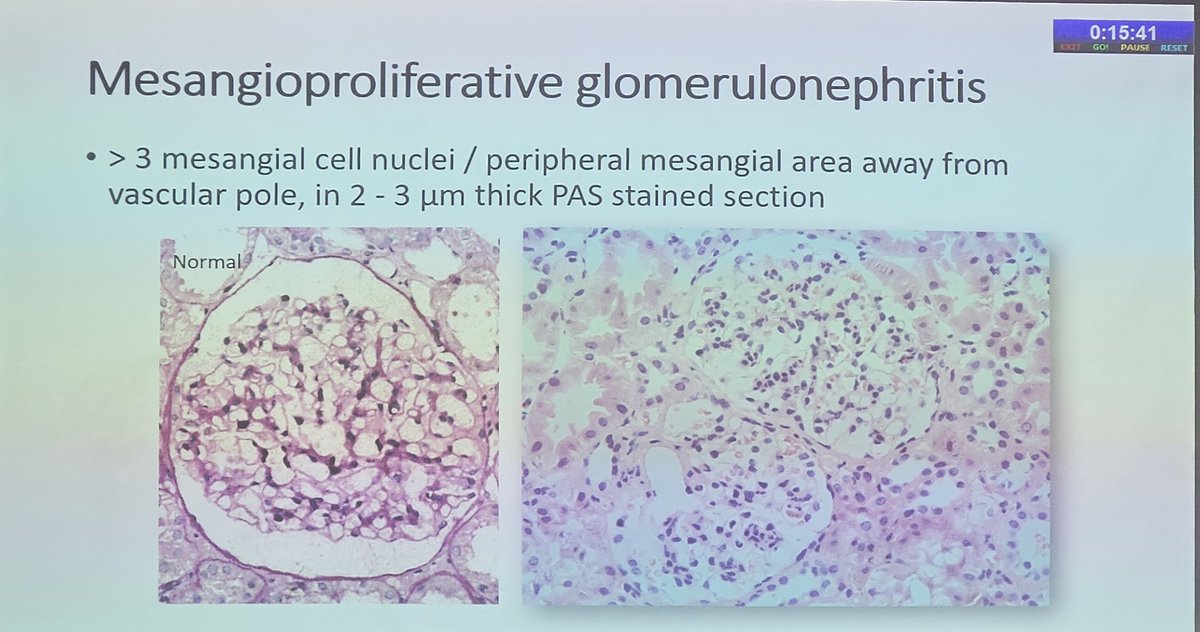 #Apcon2023 #Askrenal #pathology #PathX #nephropath #renalpath #Renalpath #Nephpearls #Kidneypath #pathboards