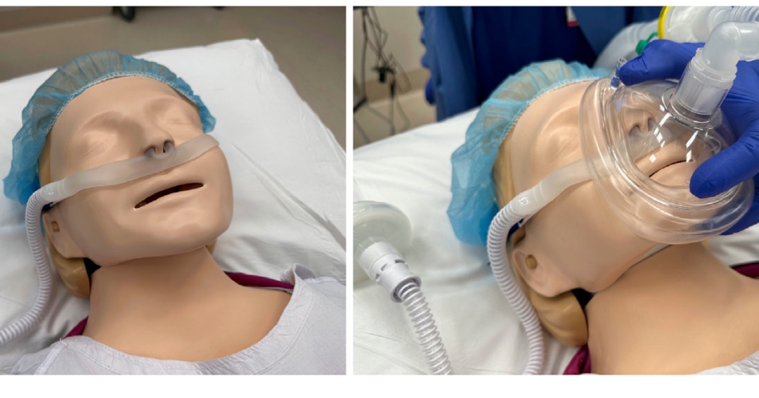 British Journal of Anaesthesia (@bjajournals) on Twitter photo Optiflow Switch™: a clinical evaluation case series in general anaesthesia for Caesarean delivery. New correspondence by Tan et al #oxygen #obstetrics #LSCS <a href="/DrPatCFTan/">Patrick Tan</a>
bjanaesthesia.org/article/S0007-… Optiflow Switch™: a clinical evaluation case series in general anaesthesia for Caesarean delivery. New correspondence by Tan et al #oxygen #obstetrics #LSCS <a href="/DrPatCFTan/">Patrick Tan</a>
bjanaesthesia.org/article/S0007-…