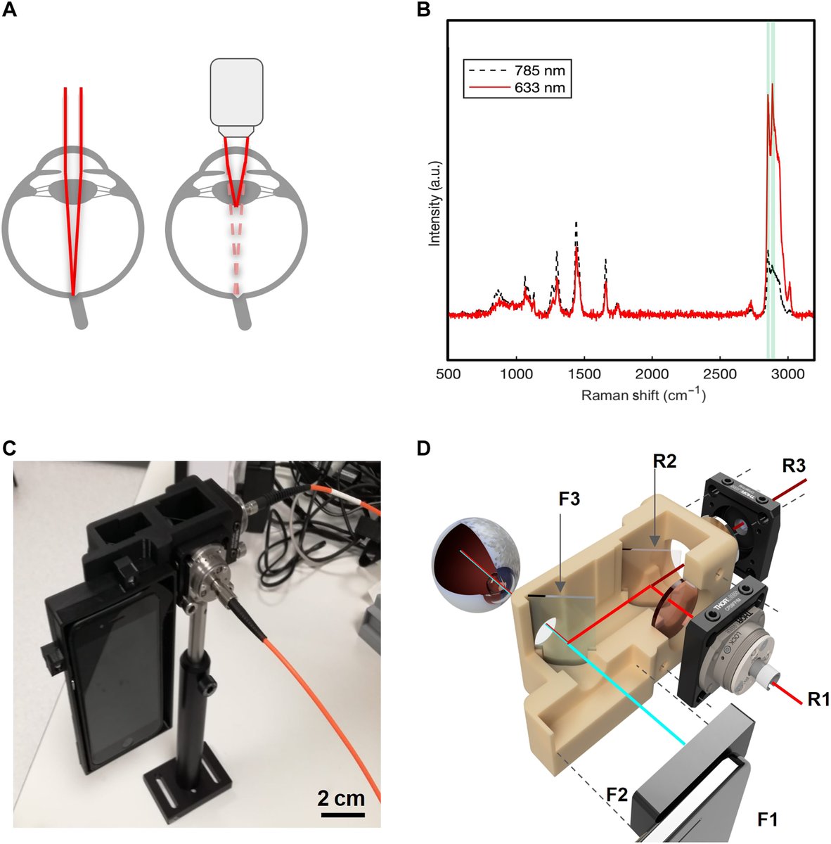 Michael F. Chiang, MD (@neidirector) on Twitter photo Impressive work involving the eye-brain axis: a new, eye-safe ocular imaging device to scan the optic nerve and diagnose traumatic brain injury (TBI).
<a href="/ANMSAgroup/">Prof. Pola G. Oppenheimer</a> <a href="/ChemEngBham/">ChemEng Bham</a> <a href="/eps_unibham/">College of Engineering & Physical Sciences</a> @news_UB <a href="/unibirmingham/">Uni of Birmingham</a>
<a href="/ScienceAdvances/">Science Advances</a> paper: bit.ly/46GmJq0 Impressive work involving the eye-brain axis: a new, eye-safe ocular imaging device to scan the optic nerve and diagnose traumatic brain injury (TBI).
<a href="/ANMSAgroup/">Prof. Pola G. Oppenheimer</a> <a href="/ChemEngBham/">ChemEng Bham</a> <a href="/eps_unibham/">College of Engineering & Physical Sciences</a> @news_UB <a href="/unibirmingham/">Uni of Birmingham</a>
<a href="/ScienceAdvances/">Science Advances</a> paper: bit.ly/46GmJq0