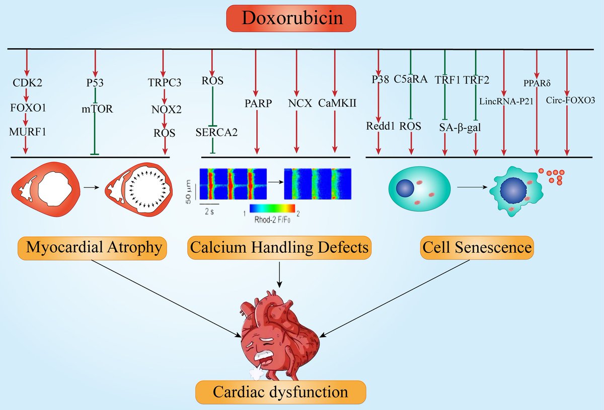 ZHeart11768530's tweet image. Recent Advances in the Mechanisms of Cell Death and Dysfunction in Doxorubicin Cardiotoxicity 🖍️ #Review 

imrpress.com/journal/RCM/24…
#Cardiotoxicity #dysfunction #cardiomyocyte #Doxorubicin #anthracycline #cell
#cardiology #meded #CardioEd #CardioTwitter #Cardiogen #2023review