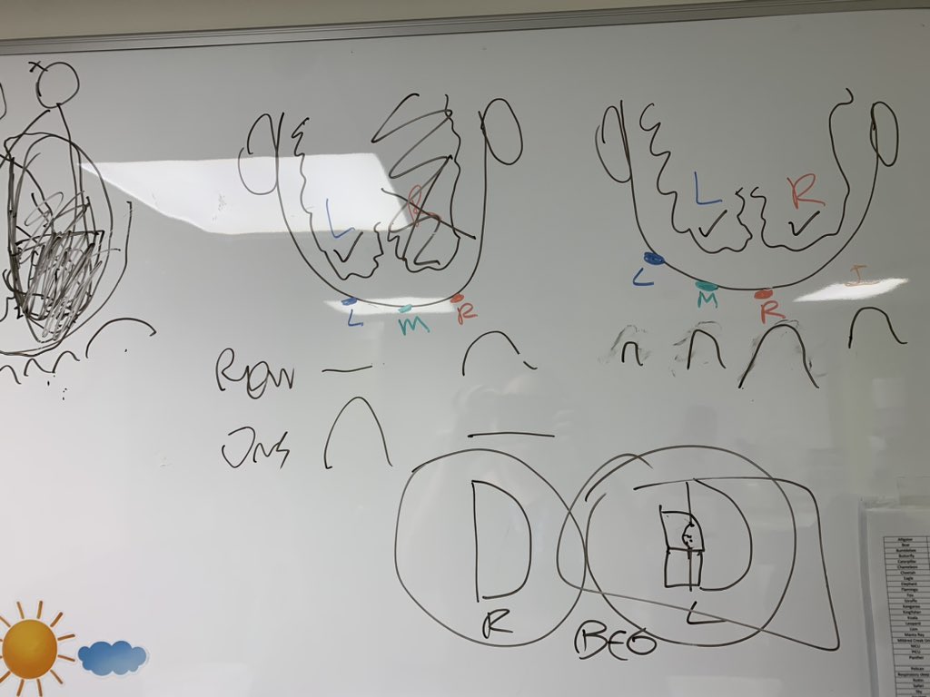 HHICProject's tweet image. A fun afternoon teaching @GoshSight  about how we use pattern VEPs to look for evidence of Homonymous hemianopia in children. Read more in our open access review in @Eye_Journal nature.com/articles/s4143…