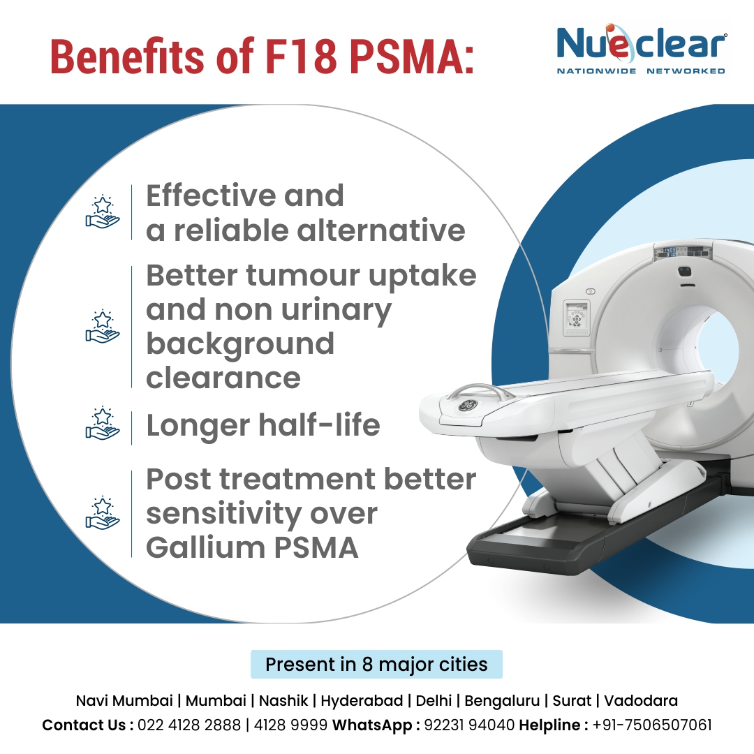 NueclearScans's tweet photo. Curious about why F18 takes the spotlight instead of Gallium PSMA? Here are the reasons behind choosing this radiotracer! 🧐 

#PSMA #ProstateCancer #ProstateCancerStaging #MedicalAdvances #PSMAPET #RadiotracerComparison #MedicalScienceDemystified https://t.co/rVQEMXOR6t