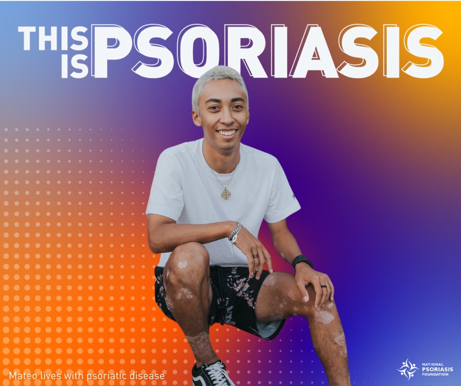 When Mateo first noticed he had psoriasis he remembers that 'it was really important that people didn’t ask questions.' Now, almost 20 years later he is not only comfortable in his skin, but his psoriasis is even a conversation starter. ✨ psoriasis.org/advance/the-po… #ThisIsPsoriasis