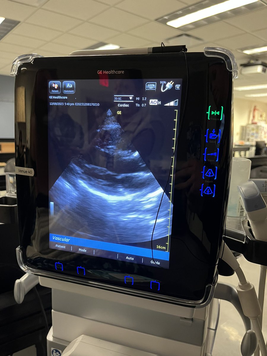 Hoosier Hills Career Center tweet media