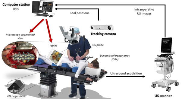 Want to help people with cancer? CIHR-funded positions for 1 PDF &amp; 2 PhDs to work on ultrasound-based Image-Guided NeuroSurgery of the spine (registration, segmentation, augmented reality) in a great environment. <a href="/TheNeuro_MNI/">The Neuro</a> <a href="/bic_mni/">The McConnell Brain Imaging Centre (BIC)</a> @NISTlab @McGillBME
nist.mni.mcgill.ca/available-posi…