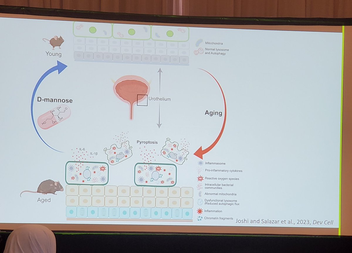 Society for Pelvic Research (@soc4pelvicres) on Twitter photo Keynote speaker Dr. Indira Mysorekar <a href="/MysorekarLab/">Dr. Indira Mysorekar</a> highlights age associated changes in urothelialR physiology and the impact on recurrent UTI #PelvRes23 Keynote speaker Dr. Indira Mysorekar <a href="/MysorekarLab/">Dr. Indira Mysorekar</a> highlights age associated changes in urothelialR physiology and the impact on recurrent UTI #PelvRes23
