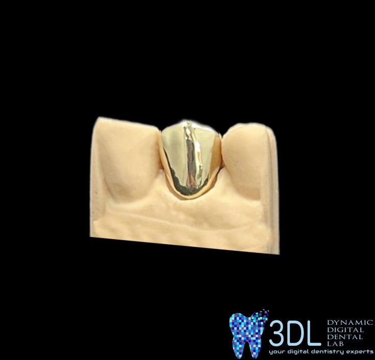 dynamicdigident's tweet image. From winter&apos;s embrace to golden grace – our crowns bring joy to every face! 💫🦷 #3DL #goldcrown