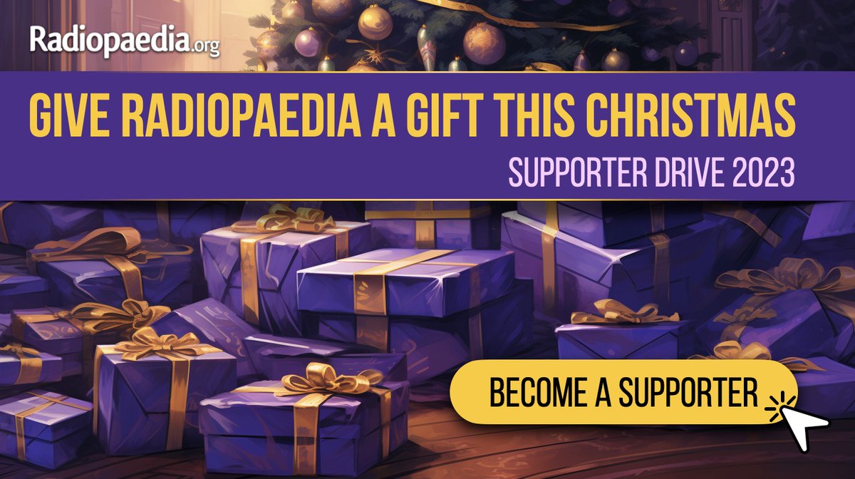 Frank Gaillard (@frankgaillard) on Twitter photo If you find <a href="/Radiopaedia/">Radiopaedia.org</a> useful, please consider putting a little something under its tree this Xmas. Remember that Radiopaedia is free because of supporters just like you. radiopaedia.org/supporter-drive If you find <a href="/Radiopaedia/">Radiopaedia.org</a> useful, please consider putting a little something under its tree this Xmas. Remember that Radiopaedia is free because of supporters just like you. radiopaedia.org/supporter-drive