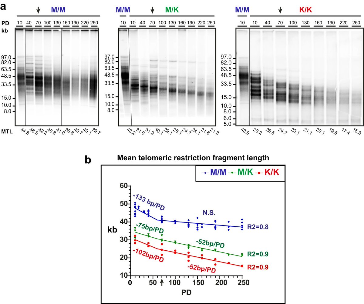 PennMedCSO's tweet photo. Telomouse - a mouse model with human-length telomeres generated by an amino acid change in #RTEL1 ft. @CatherineLeeMay, @VivianOrtizMD, Mark Tigue, Hannah Kolev, Melissa Rowe, Yitzhak Reizel, Ashleigh Morgan &amp; @KlausKaestner (@PennGenetics/ @PennIDOM) https://t.co/LIV1aVojaH https://t.co/lEQATe0tgN