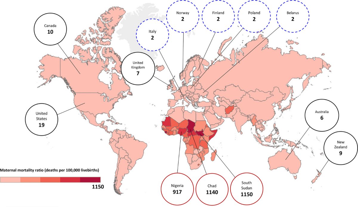 OBMedicine's tweet photo. December 2023 issue:

Maternal mortality in Canada &amp; the need for a national confidential enquiry system by @KayvanAflaki &amp; Joel Ray.

https://t.co/cA52O1VkhP https://t.co/SNW5nM9SBQ