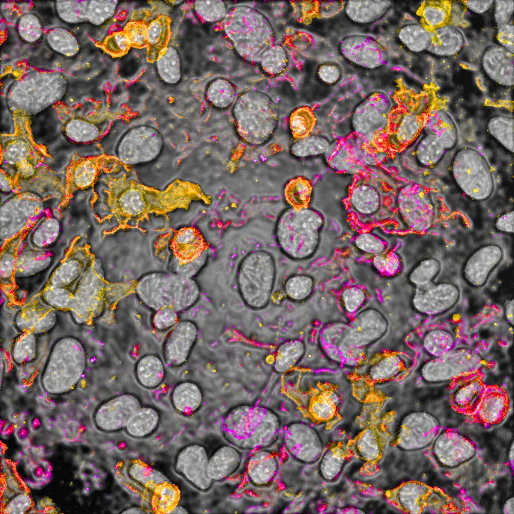 For #fluorescencefriday 🥳👩‍🔬 enjoy these beautiful macrophages crawling around a culture dish 🤩 #orthotwitter #fracturefriday #stemcells #womeninscience #womeninstem #devbio