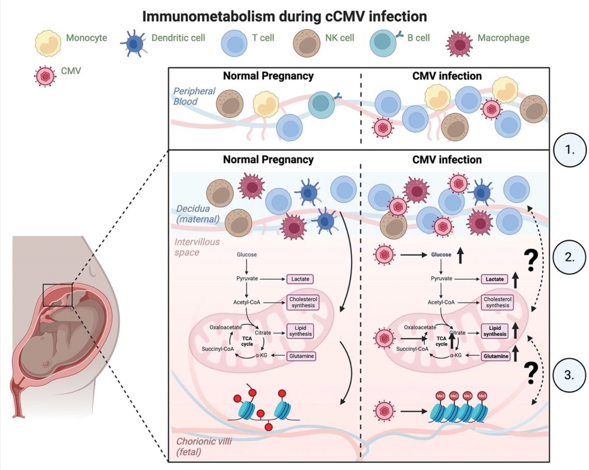 ImmunoMet's tweet image. Great Viewpoint:
Immunometabolism in congenital CMV infection.
#immunometabolism #metabolism
rb.gy/l753r2