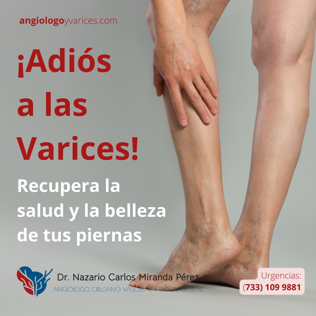 AngioVarices's tweet photo. ... cuida tus venas!
El doctor Nazario cuidará y tratará tus padecimientos de circulación...

Agenda tu cita:
https://t.co/20R78OpIDi

#AngiologoyVarices #DrNazario #CirujanoVascular #Endovascular #Tumoresvasculares #malformacionesVasculares #Angiologo #CuidadoDeVenas https://t.co/WMiZNajbDh