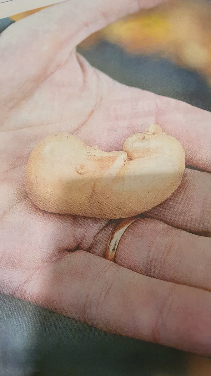SGPBunschoten's tweet photo. Niet het aankaarten van abortus is misselijkmakend, maar het doden van ongeboren leven.
#hugobos
#Kamerledenfurieusoverabirtusbrief
#10weken https://t.co/pf1tH8GN0S