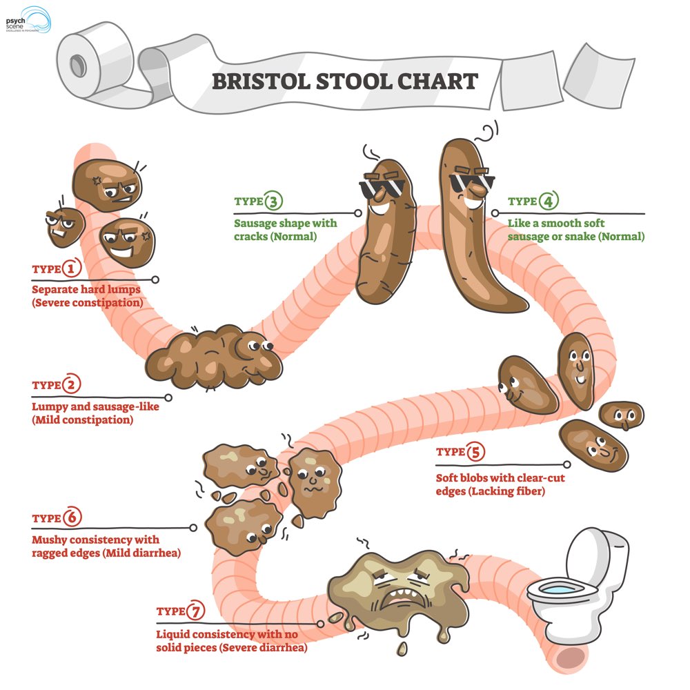 🚨Clozapine and Constipation 

This is the one side effect that easily flies under the radar BUT is associated with the highest risk of mortality. ( High case fatality - 28%! ) 

I have to constantly remind myself and remind the patient about the seriousness of this SE. 

While