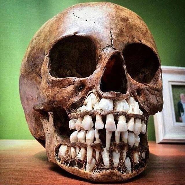 A child skull with it’s baby teeth.