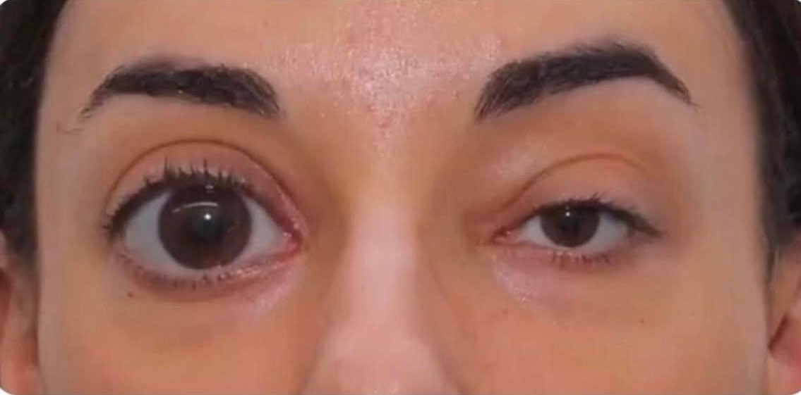 invis4yo's tweet image. nobody:

my eyes in pictures