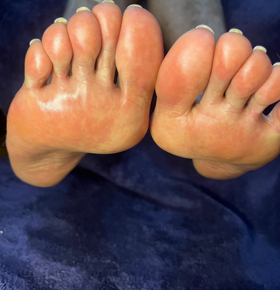 Toesuluv's tweet photo. @SolesinDahood @FootMidwest Follow me https://t.co/IWdzILWHEX