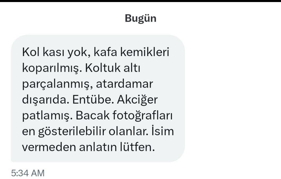 cg_merve's tweet photo. Tunahan’ın babası “benim çocuğuma köpek saldırmadı, çocuğumu köpekler yedi” dediği buymuş…

Sokakta başıboş gezen tüm köpekler uyutulmalı.

Seven evine alıp beslesin. 

Bu saçmalığı destekleyenlerin de Allah tekmilinin birden belasını versin. https://t.co/pSiZKjOR1K