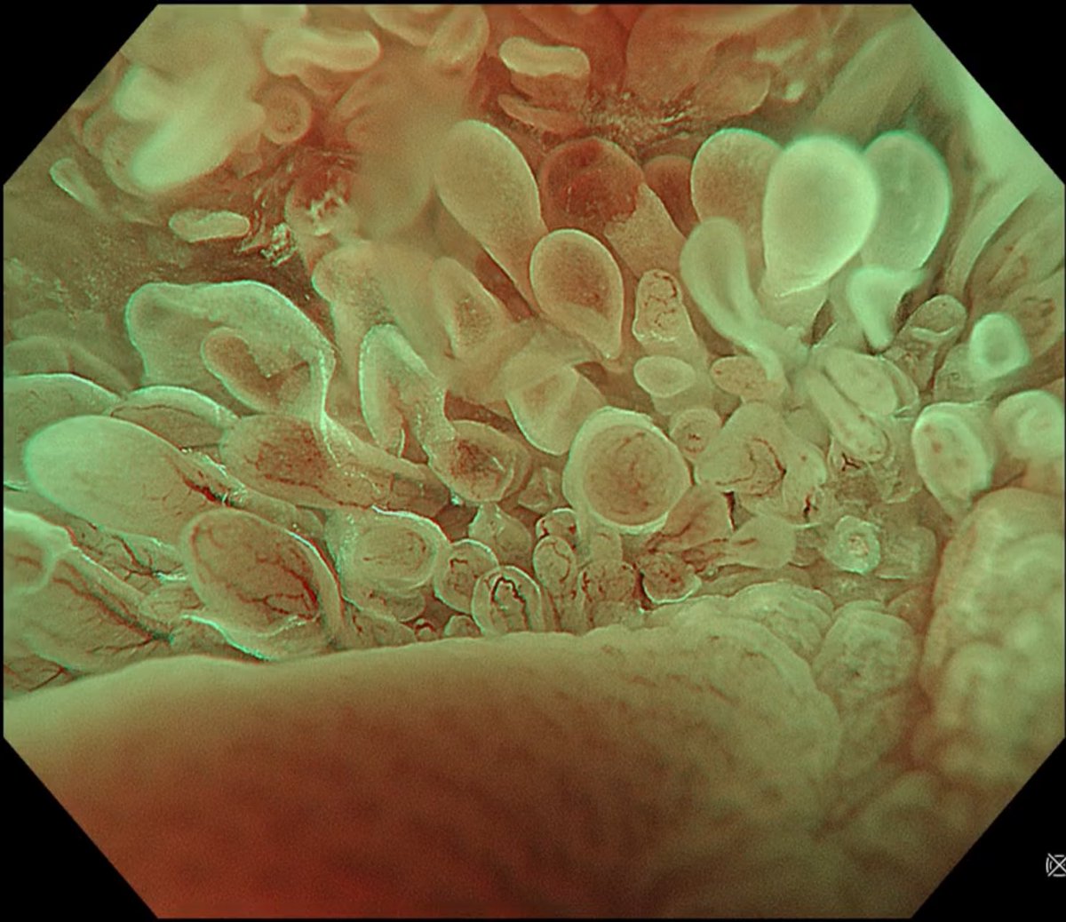 Keith Siau tweet media