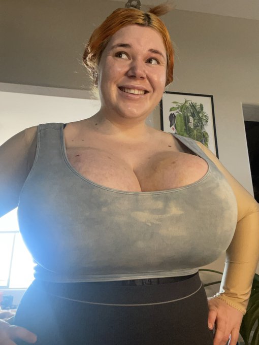 Healing beautifully!  So much bigger than my head! 😵&zwj;💫💫 https://t.co/1whHxl3G27