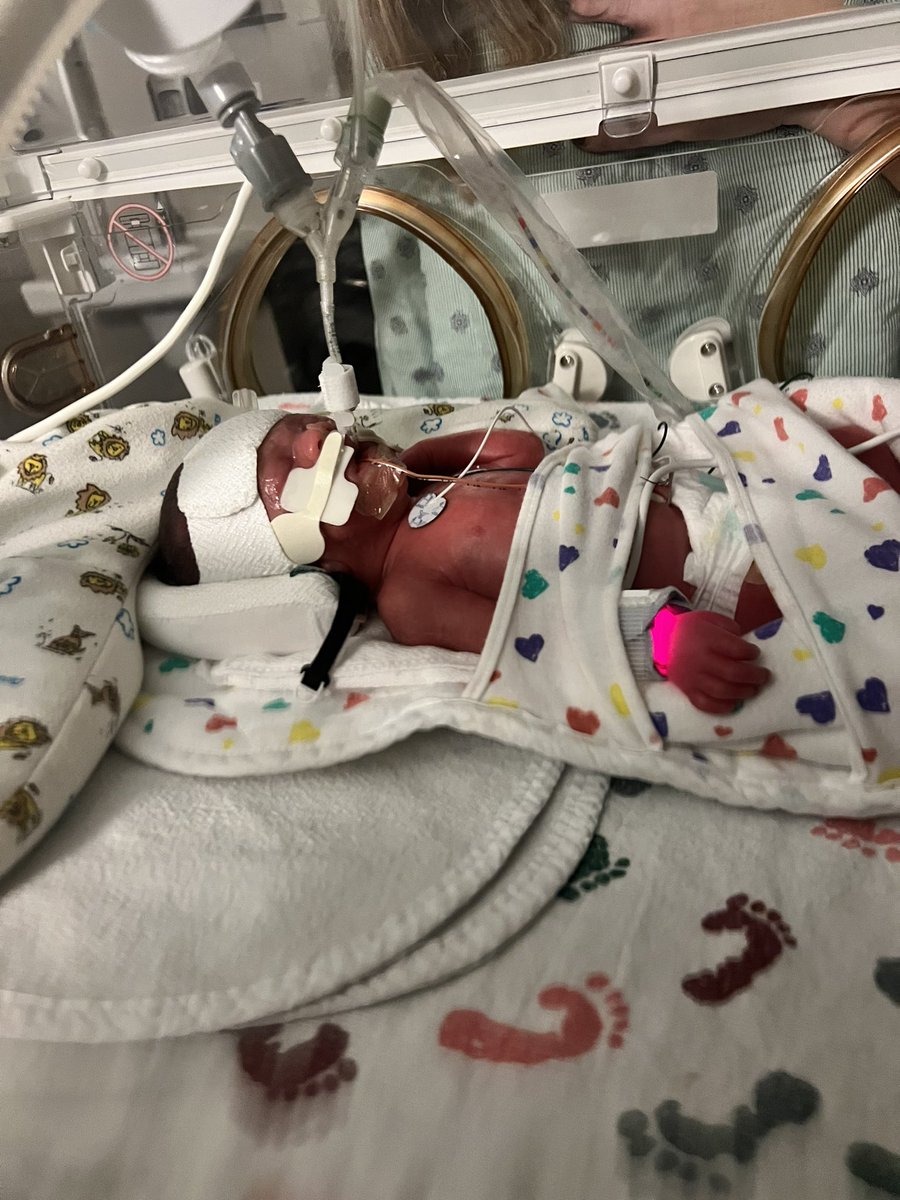 Hunter Foster tweet media