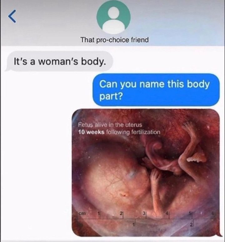 Sandollar89's tweet photo. @TheOnlyEsta @mmpadellan Except the female baby aka fetus has no rights!!
#NotHerBody
BTW If you support men posing as women in women’s sports you don’t give a rats ass about women’s rights!! https://t.co/1fcvILxKb2