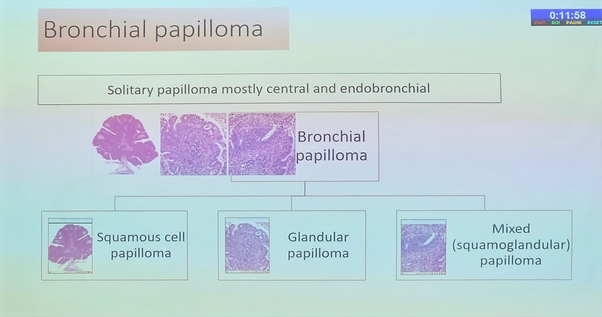 Bismaypath's tweet photo. #Apcon2023 #pulmpath #lung #Pathology #pathresidents #pathX #pathtwitter #MedX #MedTwitter https://t.co/kD6LMcyifo