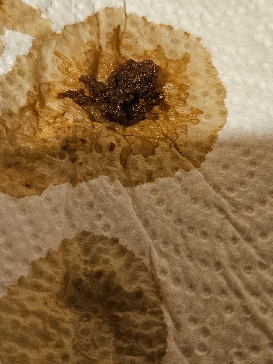 drunken_duck's tweet photo. Eeeek! Just started enjoying my can of Bourbon V.B.M and suddenly  find lumps of gunge in it like this @fiercebeer !!  Almost scared to drink the rest ....... https://t.co/VgJkCDUj3H