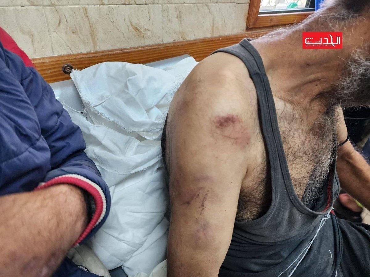 🚨Israel is arresting Palestinian men &amp; teenagers en masse; marking them with numbers like cattle; &amp; subjecting them to torture &amp; degrading treatment.

All WITHOUT charges, trial, or legal counsel...

Everyone in North Gaza is presumed &amp; treated as guilty until proven otherwise!