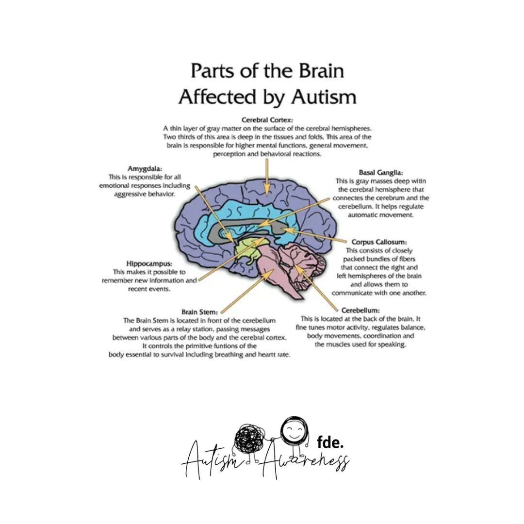 fc_maritime's tweet image. 🧠 Understanding autism and the areas of the brain affected by the condition. #autismawareness #brainfunction #neurodevelopment #neuroscience #mentalhealth #autism #autismo #fdefootball