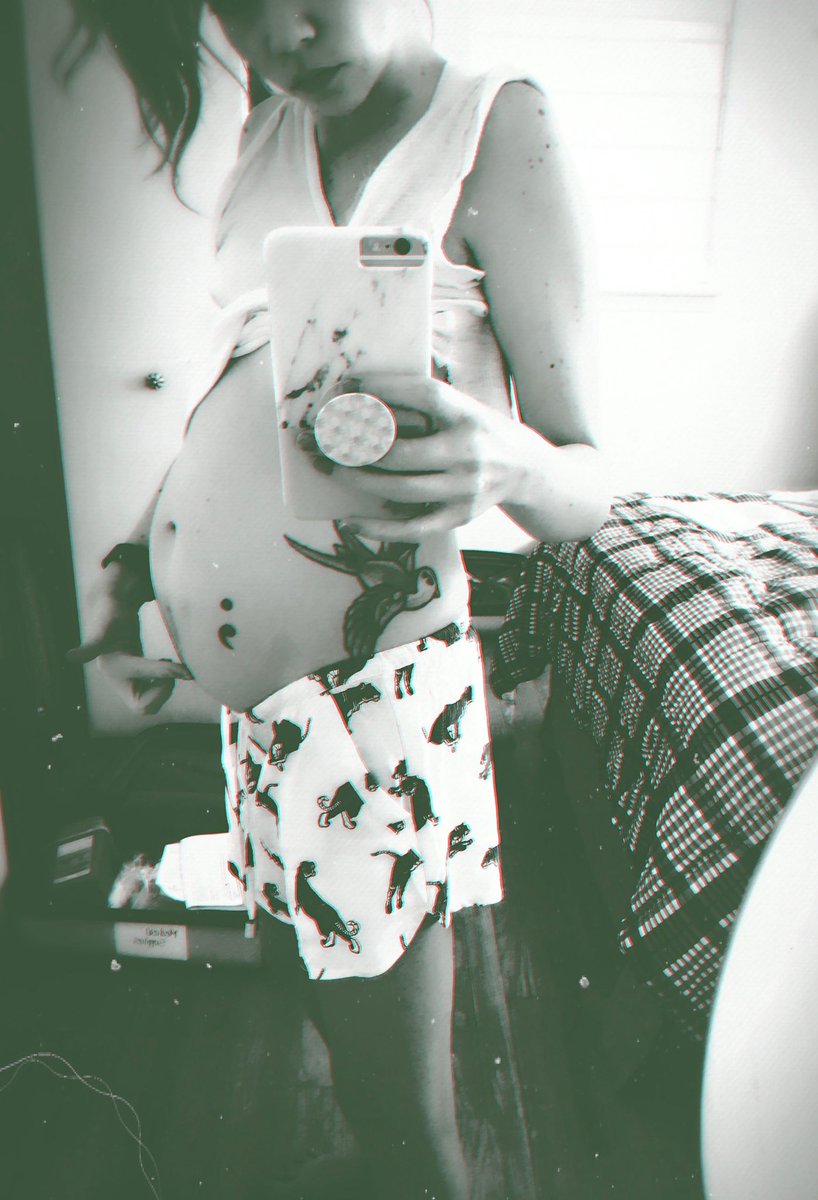 SaraRingerSharp's tweet image. An old pic of me but still relevant. This is life with an intestine that is chronically obstructed. It is painful, nauseating, and keeps me from living the life I dream of living. A surgeon and a doctor has recently given me hope and hope is a wonderful medicine.