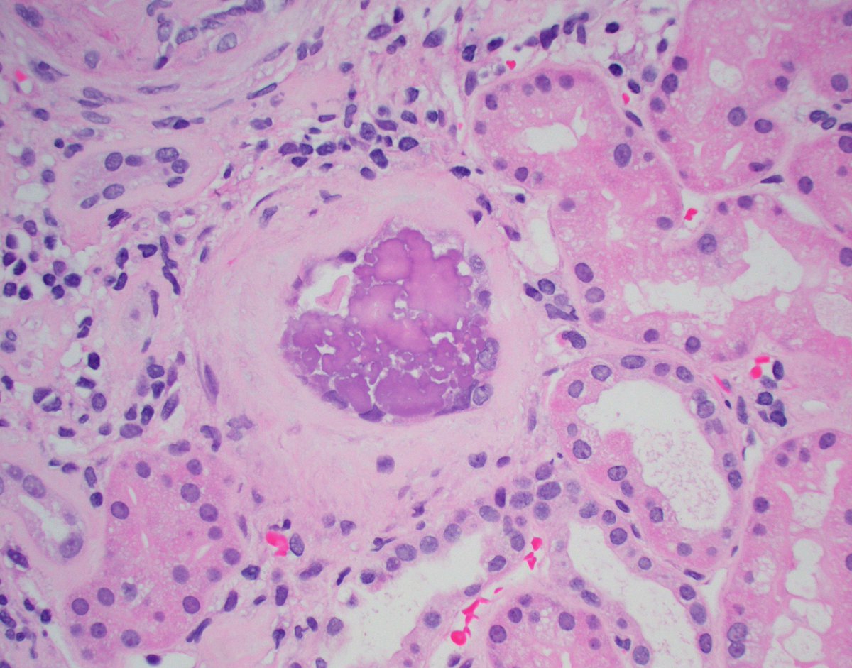 JZRenalPath tweet picture