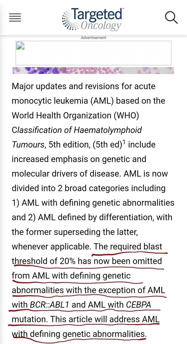 Previously, only 3 translocations were considered 'AML defining' including t(8;21), inv(16) & APL with t(15;17). I found this article tinyurl.com/3by26xju by @sanamloghavi very interesting since these were extended to all (except 2 subtypes)‼️ #hemepath youtu.be/w02ln_iPeZw?si…