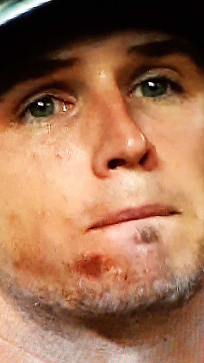 pain
