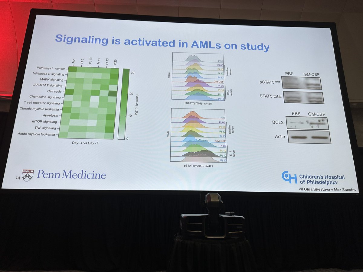 hemedoc's tweet photo. #ASH23 #leusm #celltx Bhagwat: increased pSTAT5 in AML cells during course of CART response. Ruxolitinib can abrogate protective effect of the myeloid cytokine mediated signaling that increases resistance to apoptosis in AML blasts. https://t.co/EFjuL33Mk4