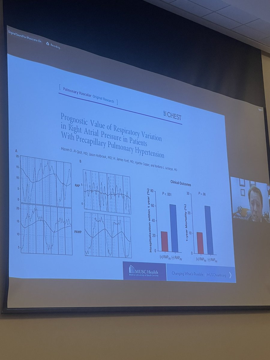 Afternoon session of @UCSFCardiology @ZSFGCare 40th Annual Cardiology CME course, focusing on HF! Next up @Brian_Houston12 discussing The People’s Ventricle, the Right Ventricle! Have to know how to identify & define RV failure. Key pearl: look at the RHC waveforms!!