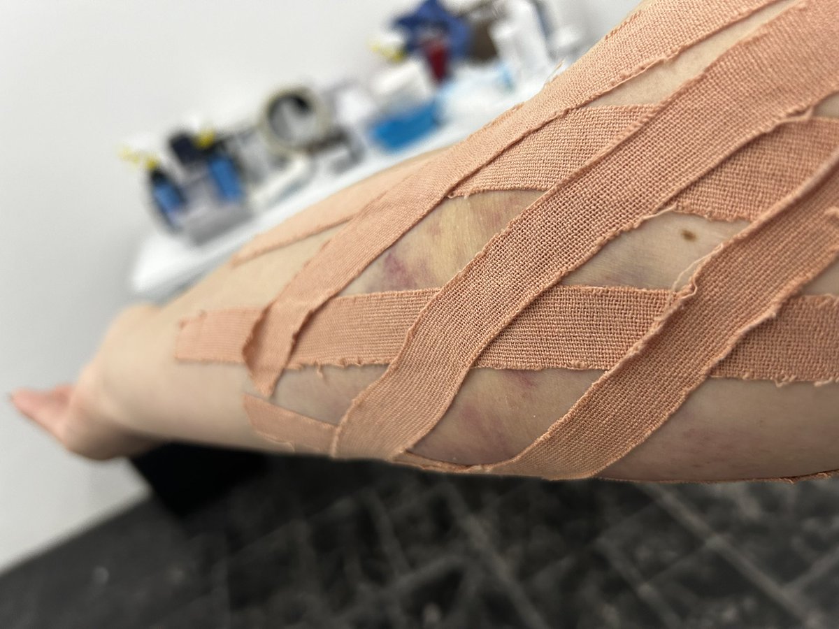 AnaBecerrilSA's tweet photo. Asi va mi brazo!!!! https://t.co/MIDp6Xtirn